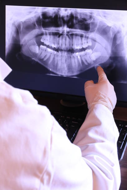 Best Broken or Chipped Tooth Repair in Mcclure, PA